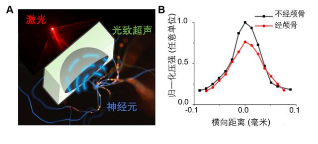 波士頓大學研發0.1mm光致超聲無創腦激發，應用于神經疾病的治療