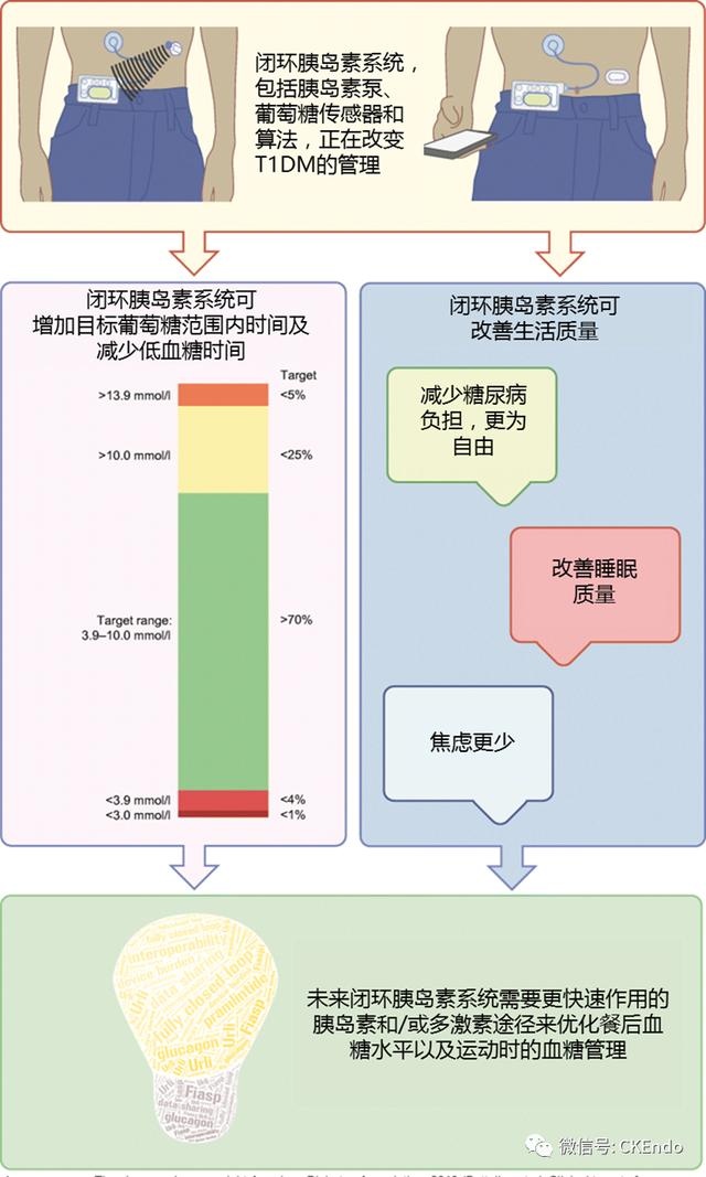 臨床內(nèi)分泌未來篇 - 2021新閉環(huán)胰島素系統(tǒng)-傳感器、胰島素泵和控制系統(tǒng)