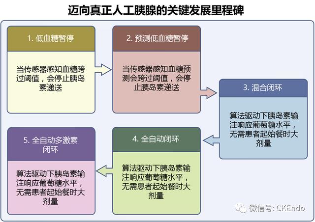 臨床內(nèi)分泌未來篇 - 2021新閉環(huán)胰島素系統(tǒng)-傳感器、胰島素泵和控制系統(tǒng)