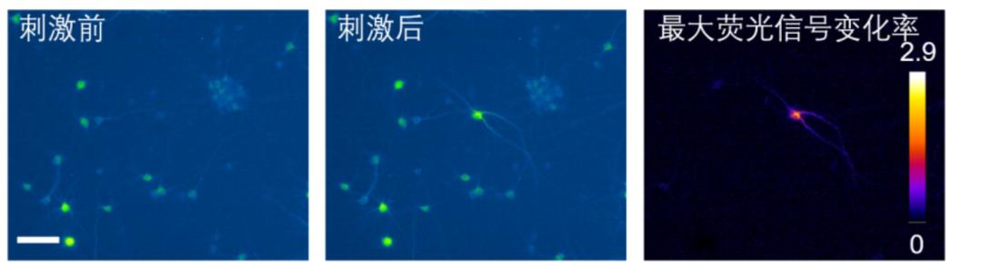 波士頓大學研發0.1mm光致超聲無創腦激發，應用于神經疾病的治療